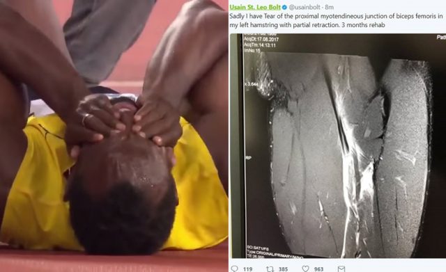 Usain Bolt shares X-ray of hamstring tear after people doubt his injury